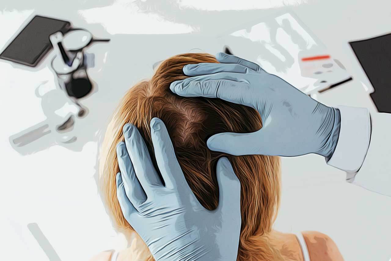 Dermatite Seborreica: Aprenda Sobre Sintomas e Tratamentos_thumbnail