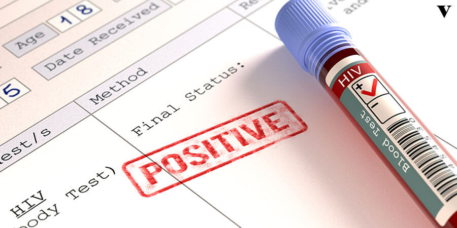 HIV: Descubra Como Ocorre a Transmissão do Vírus da AIDS_thumbnail